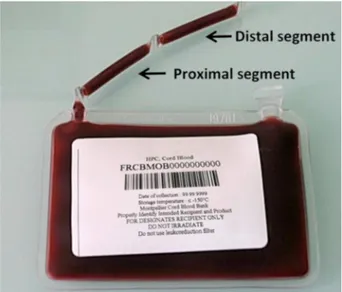 Fig. 1. Cord blood bag showing proximal and distal segments.