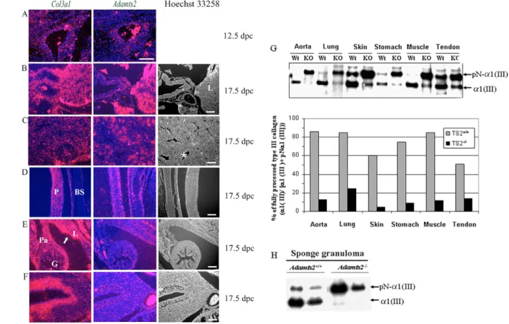 Fig. 6. Co-expression of Adamts2 and Col3a1, and deﬁciency of procollagen III processing in Adamts2 –/– mice