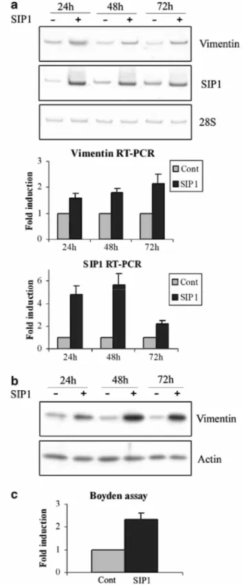 Figure 3 SIP1 transfection regulates vimentin expression, (a) RT-PCR analyses of vimentin and SIP1 expression  in MCF10A cells transiently transfected with SIP1 cDNA for 24, 48 or 72h