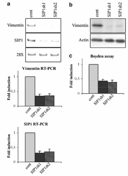 Figure 4 SIP1 shRNA decreased vimentin expression and migratory abilities of MCF10A cells