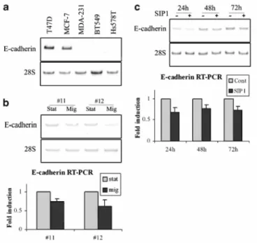 Figure 6 SIP1 expression inversely correlates with E-cadherin expression. RT-PCR analyses of E-cadherin in  five breast tumor cell lines (a), in the migratory (mig) versus stationary (stat) subpopulations of VP-EGFP  MCF10A cells plated in the migration as