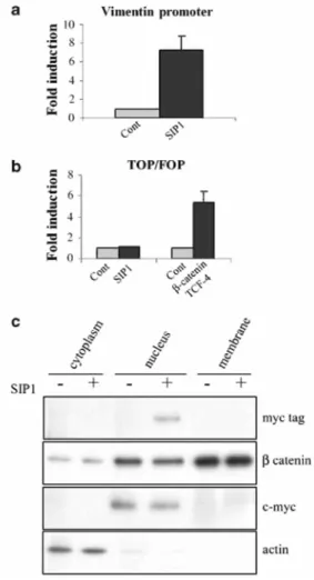 Figure 7 No implication of the β-catenin/TCF pathway in the regulation of vimentin by SIP1