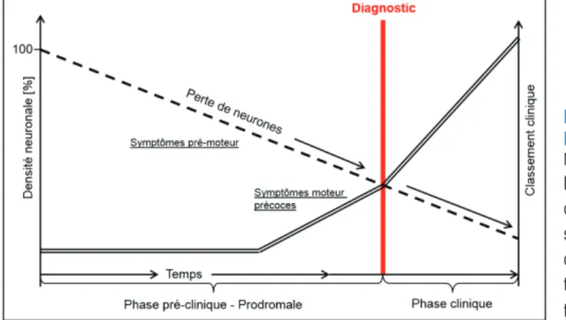 Figure 1 - Progression de la maladie de  Parkinson 