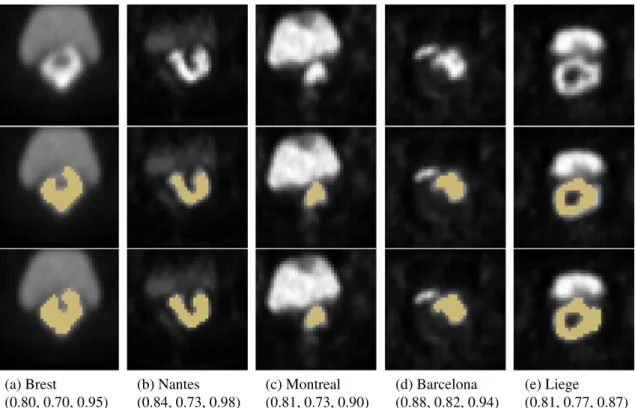 Fig. 3 Examples of the model predictions in each test fold. Axial slices. (first row) Input images, (second row) input images with ground truth segmentation, (last row) input images with predicted segmentation
