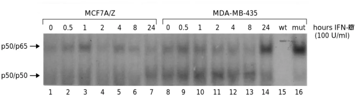 Figure 7 Analysis of NF-kB DNA-binding after interferon-g stimulation of breast cancer cell lines MCF7 A/Z and MDA-MB- MDA-MB-435