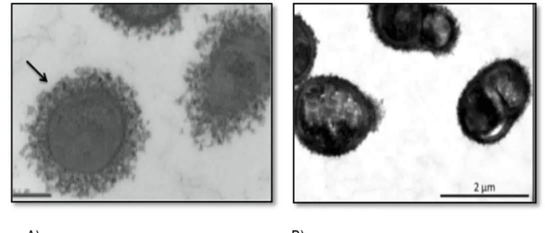 Figure 1-10 : Photo en microscopie électronique à transmission de deux souches de S. suis