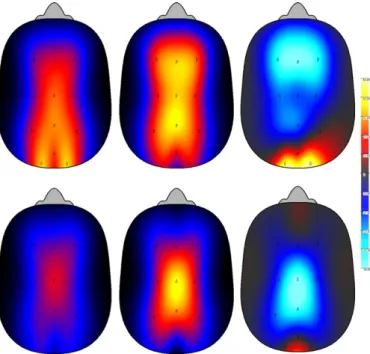 Fig. 5. Top panel illustrates the topographical REM sleep EEG power density in alpha activity (10–12 Hz) during dream recall and no recall