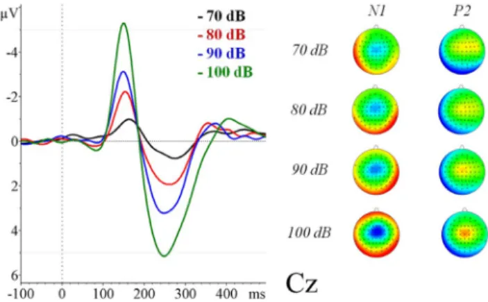 Figure 1. Grand average (n = 16) of the auditory evoked related potentials for the different sound pressure levels at Cz measured inside the scanner.