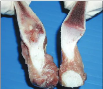 Figure 4.  Enlargedcostochondraljunction(CCJ)showing alargeandirregularareaofsuppurativeosteomyelitisand chondritis(leftrib)comparedtoanormalCCJ(rightrib).