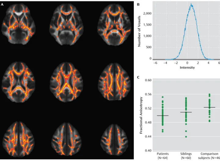 FIGURE 1. Voxel-Wise Comparisons in a Study of White Matter Integrity in Bipolar Disorder a a  Panel A depicts voxel-wise analysis showing reduced fractional anisotropy in bipolar patients relative to healthy comparison subjects (p&lt;0.05, family-wise err