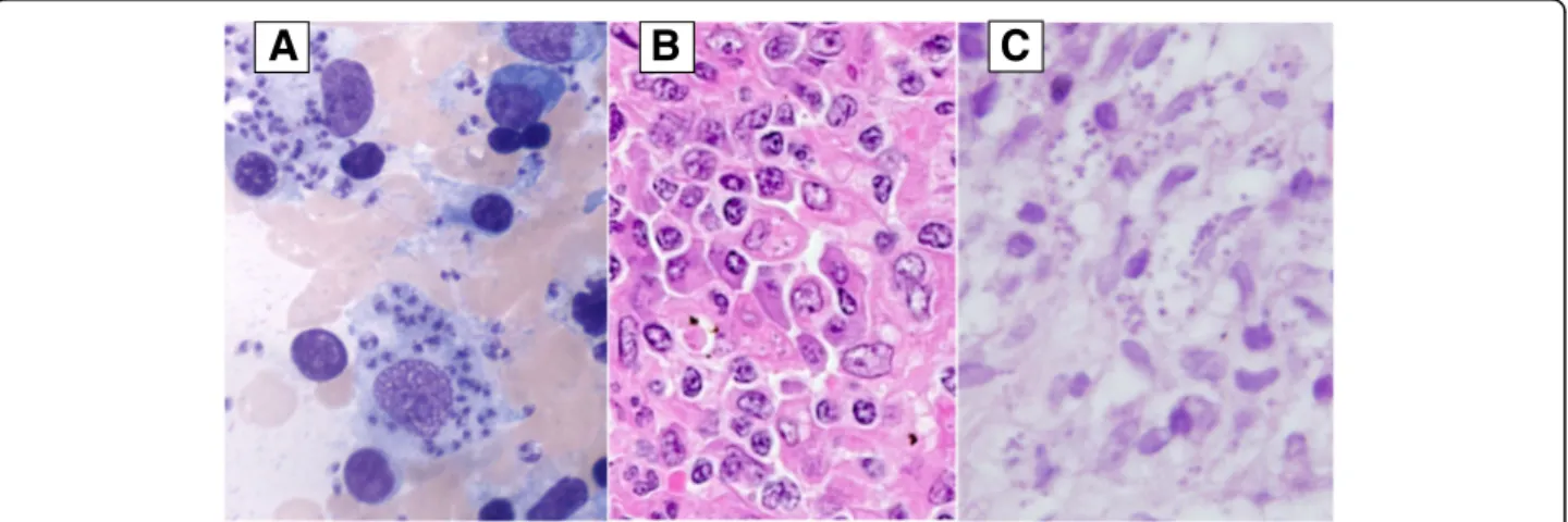 Fig. 1 Visceral and cutaneous leishmaniasis. a. Bone marrow aspirate: May Grunwald Giemsa (original magnification: ×1000) showing two macrophages with abundant cytoplasm containing innumerable Leishmania amastigotes