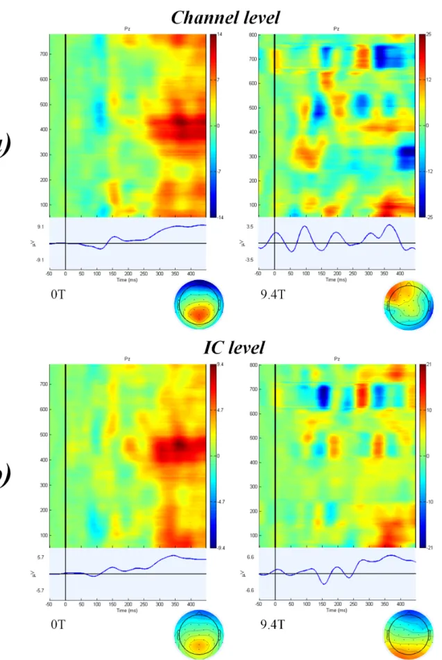 Figure 3. Average of all trials in 26 subjects after auditory stimulation (target stimuli) at (a) channel level after ICA-based BCG artefact correction and (b) IC level