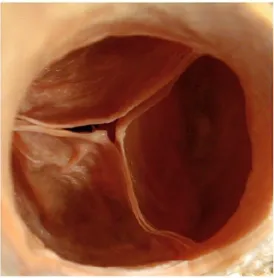 Figure 1.2. Vue supérieure de la valve aortique montrant ses trois feuillets (ou valvules) 
