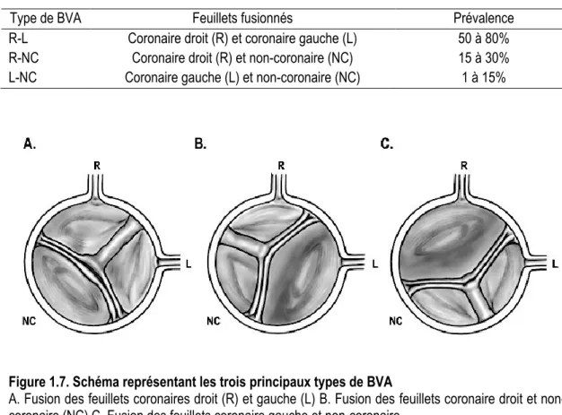 Tableau 1.1 Principaux types de BVA 