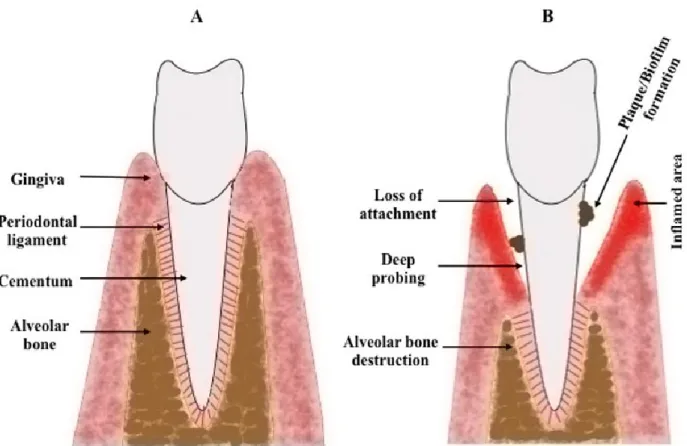 Figure 1-6: Anatomic schema of the periodontal tissue and its cigarette smoke-induced diseases