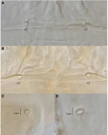 Fig. 3 Morphological differences between Brevipalpus obovatus Donnadieu and B. chilensis Baker