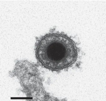 Figure 3. Electron micrograph  image of cyprinid herpesvirus 3 virion. 