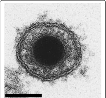 Figure 2 Electron microscopy examination of CyHV-3 virion. Bar represents 100 nm. Adapted with permission from Mettenleiter et al