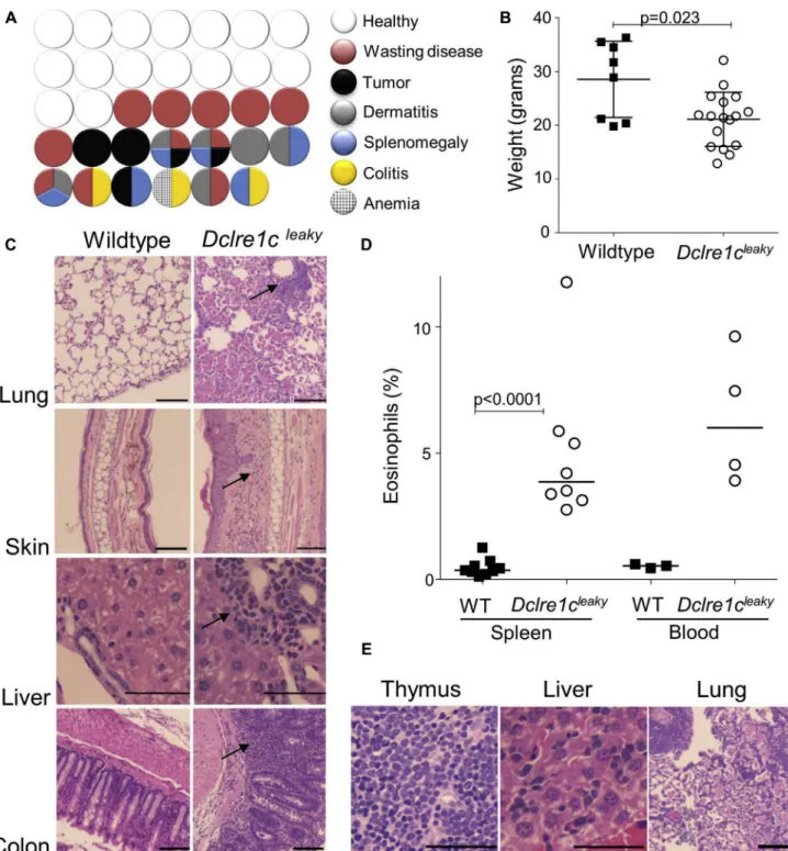 FIG 5. Dclre1c leaky mice are affected by inflammatory diseases and lymphoma. Mice were evaluated at 8 to 10 months of age for disease incidence and markers of inflammation