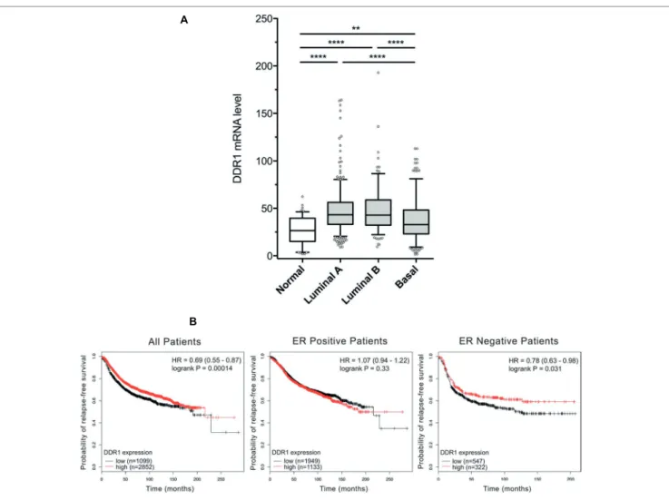 FIGURE 2  |  DDR1 expression in breast cancer and the associated correlation with prognosis in ER negative tumors