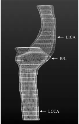 Figure 6: Construction d'un modèle tridimensionnel  de paroi carotidienne par IRM. Tiré  de Varghese et al