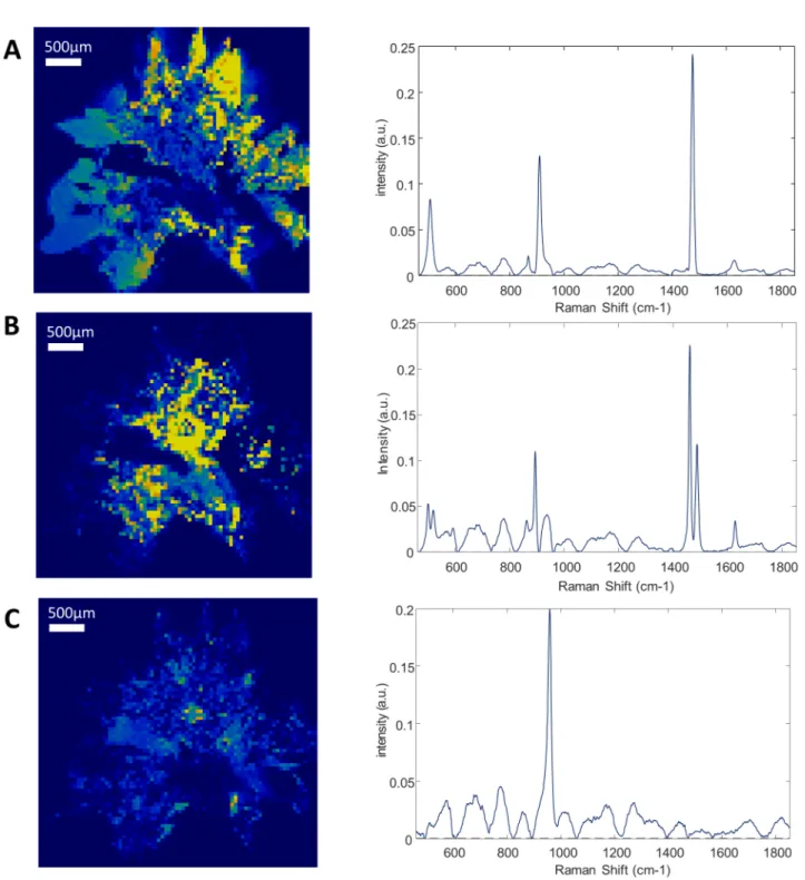 Fig 1. Raman mapping of sample 3. Raman mapping of the calcium oxalate dihydrate (A), calcium oxalate monohydrate (B) and apatite (C) and their correspondent Raman spectra