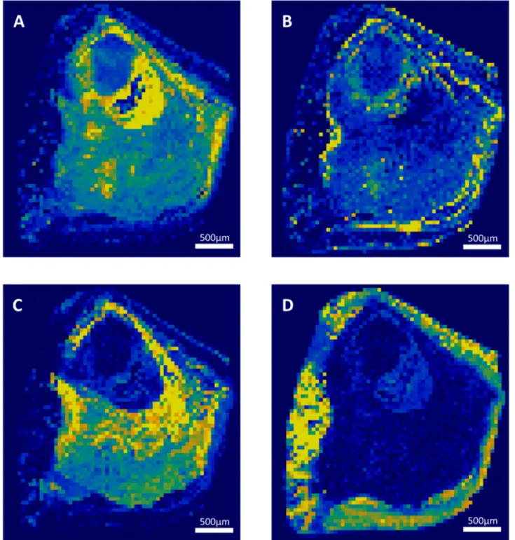 Fig 2. Raman mapping of sample 9. Raman mapping of whitlockite (A), calcium oxalate dihydrate (B), apatite (C), and brushite (D)