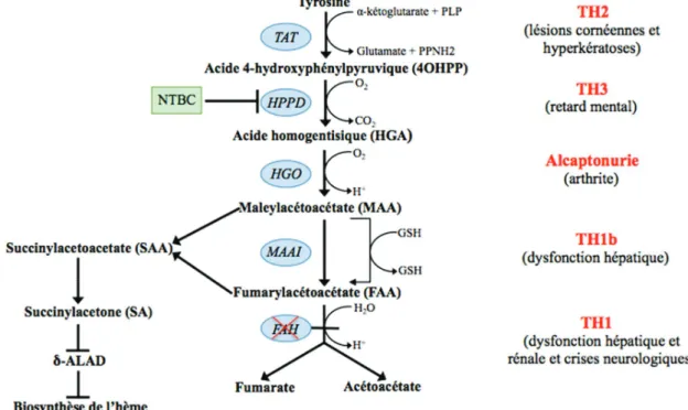 Figure 1. Le sentier catabolique de la tyrosine et les maladies associées