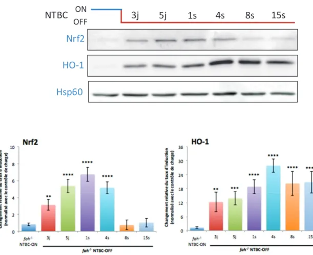 Figure 14. Analyse par immunobuvardage de l’expression protéique de marqueurs liés au stress oxydant dans le foie de souris fah -/-  lors du retrait du NTBC