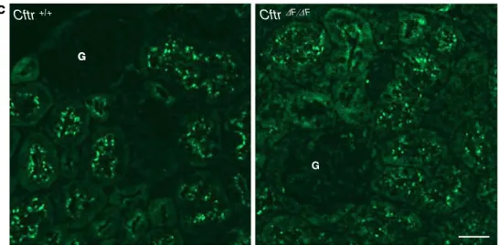 Fig. 2 Gentamicin uptake in proximal tubule cells. Primary cultures of proximal tubule cells (mPTC) obtained from Clcn5 Y/+ (wild-type, a – d), Clcn5 Y/− (e – h), and Cftr ΔF/ΔF (i – l) kidneys exposed to 5 mg/mL gentamicin (37°C for 7 min or 45 min)