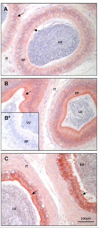 Figure II-5 :  Immunohistochemical  localization  of  bovine  DCXR  protein  along  the  bovine epididymis