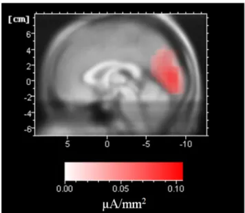 Figure 3. DMN identified from the group analysis of the 15 subjects.