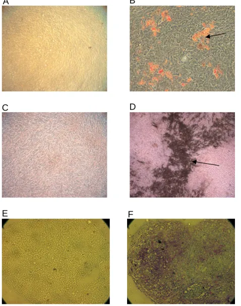 Figure  3:  MSC  differentiation  of  passage  1  (A-D)  and  passage  5  (E-F).  A:  Control  culture  incubated  in  MSCGM  and  stained  with  Oil  Red  O;  B:  Induction  of  fat  cell  differentiation  and  staining  with  Oil  Red  O  (magnification 