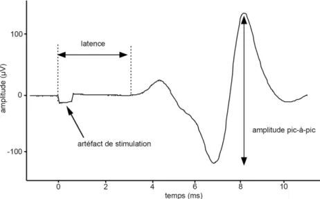 Figure 2. Amplitude pic-à-pic et latence des potentiels évoqués moteurs 84 . Le temps = 0 ms  correspond au moment de la stimulation magnétique trancrânienne