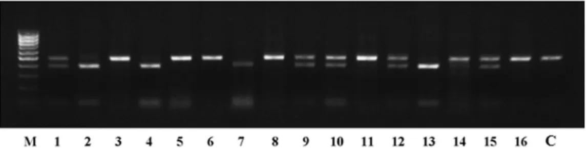 Fig. 1. Gel electrophoresis of thePICALM gene restriction products. M is the SibEnzyme 100-bp marker