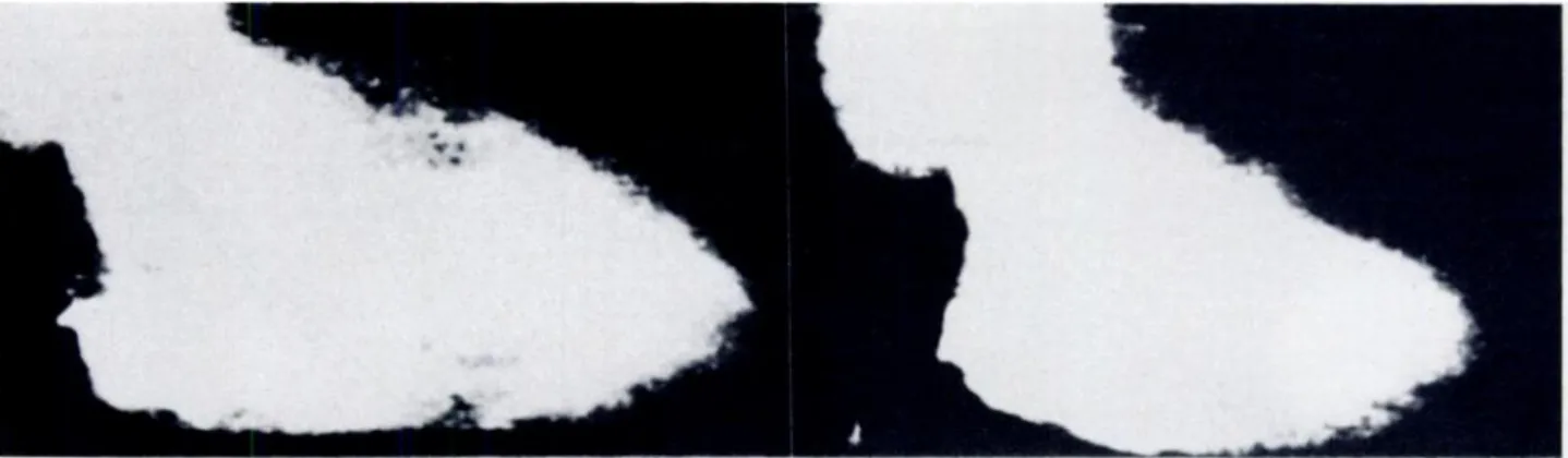 FIGURE 1. End-diastolic (left) and end-systolic (right) frames of a low-contrast dose, direct digital ventriculogram