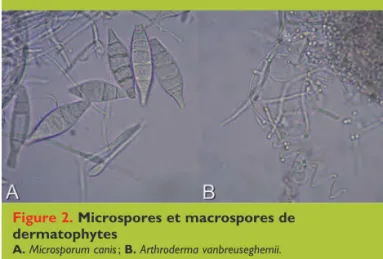 Tableau 1. Classification des dermatophytes en  espèces géophiles, zoophiles, et anthropophiles (A :  Arthroderma ;  M :  Microsporum ;  T :  Trichophyton ;  E :  Epidermophyton).