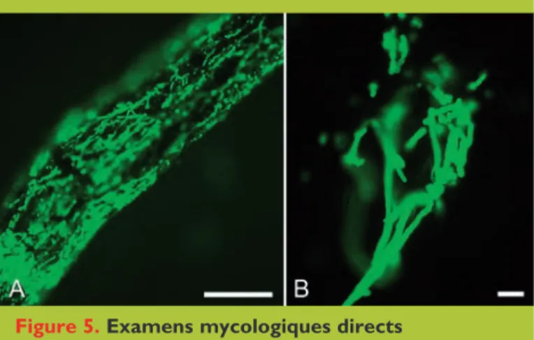 Figure 5. Examens mycologiques directs
