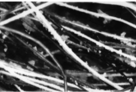 Figure 2 Polarized light microscopy of dandruff adhering to a hair shaft.