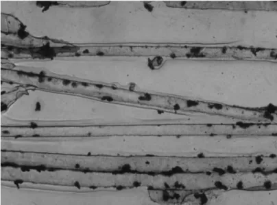 Figure 4 Mean and SD of dandruff density per cm of hair in 25  sub-jects. Dandruff density (N cm –1 ) 051015202530 30 40 50 60 70 80 90