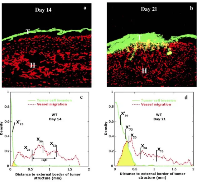 Fig. 3: Histological analysis of kinetic tumor transplantation. Immunofluorescence labeling of malignant  keratinocytes (green) and vessels (red) in transplanted tumors observed at 14 days (a) and 21 days (b) in  wild-type mice, (b) Yellow represents inter