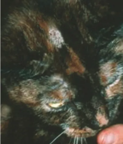 Figure 3 On many occasions dermatophytosis lesions start on the head.