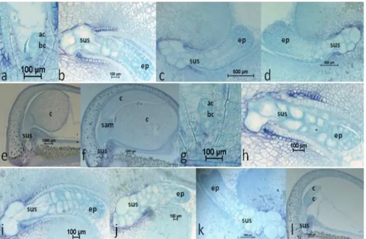 Figure 2. Longitudinal sections of Phaseolus vulgaris BAT93 developing embryos at 0 (a and g), 3 (b and h), 5 (c and i), 7  (d and j), 10 (e and k) and 12 (f and l) days after anthesis (DAA)