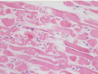 Fig 5. Diaphragm 400, hematoxylin and eosin.