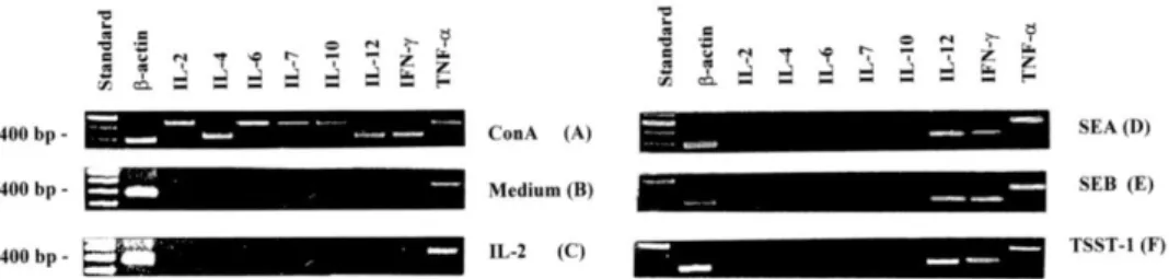 Fig. 4.  RT-PCR products of b-actin, IL-2, IL-4, IL-6, IL-7, IL-10, IL-12, IFN-g and TNF-a in purified WC1 +  gd  T cells activated with SEA (D), SEB (E) or TSST-1 (F) in the presence of glutaraldehyde-fixed APC and IL-2  for 4 days