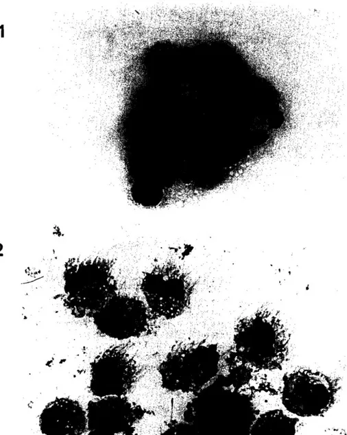 Fig. 2.  Morphology of DCI and DC2: cells were prepared by cytospin and were processed for May Grlinwald  Giemsa staining