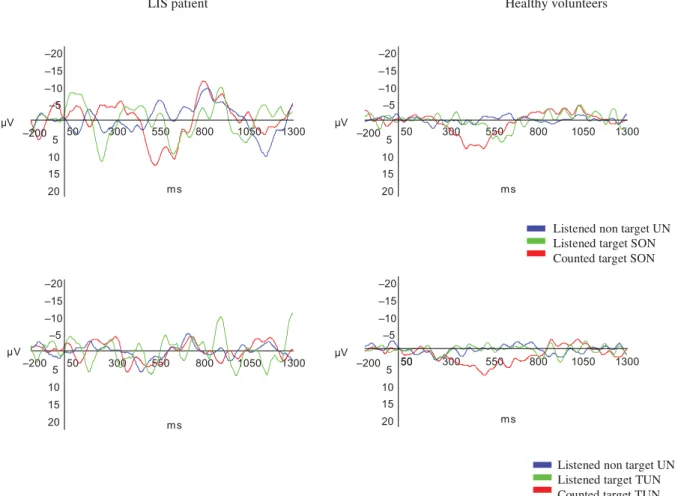 Figure 1. Grand-averaged event-related potentials in our LIS patient and in healthy volunteers (n = 4) at Pz