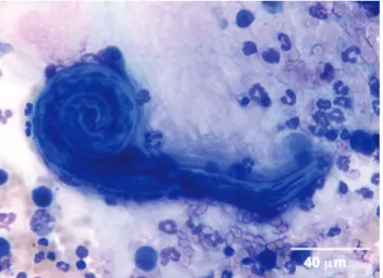 FIG 3. Cytological detection of Angiostrongylus vasorum L1 larva in  broncho-alveolar lavage fluid from one dog (May-Grünwald-Giemsa stain