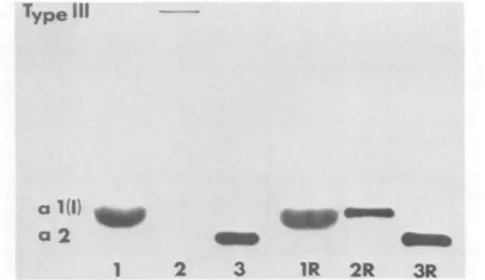 Fig. 8. Fluororadioautograph of an SDS-polyacrylamide slab gel of the collagen chains eluted in the three peaks of the CM-cellulose chromatogram demonstrates the presence of the types I and III collagen synthesized by cultured keratoconus stromaeytes