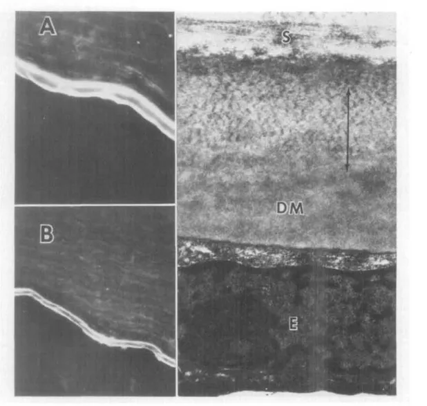 Fig. 5. Fluorescence micrographs (A, X450; B, X300) of a section of normal cornea reacted with antifibronectin antibody exhibits fluorescent anterior and posterior portions of  Des-cemet's membrane identical to that pattern seen with anti-type IV antibodie